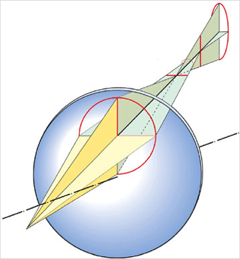 Astigmst schiefer b�ndel